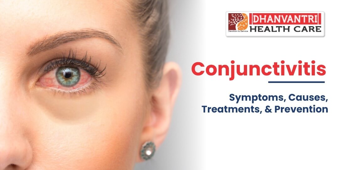 Conjunctivitis - Symptoms, Causes, Treatments, and Prevention